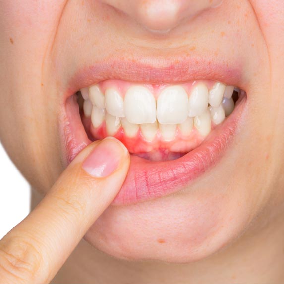 Periodoncia